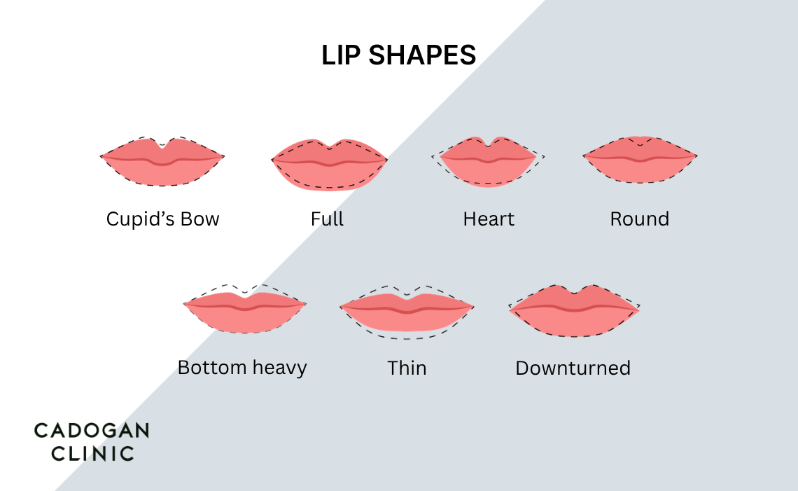 Infographic showing different lip shapes